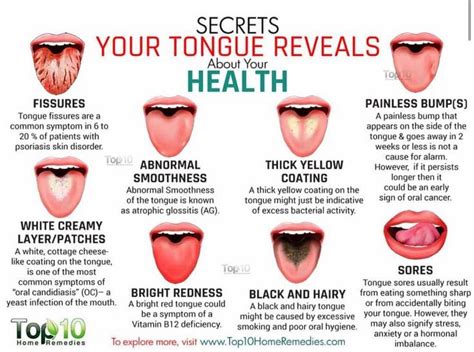 What Happens If You Exceed Tongue Weight?