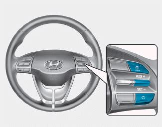 Does Hyundai Have Speed Limiter?