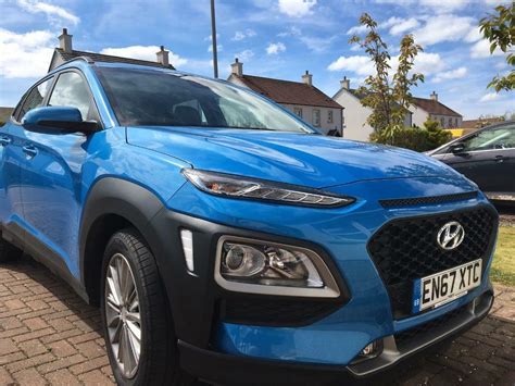 Does The Hyundai Kona Have A Reversing Camera?